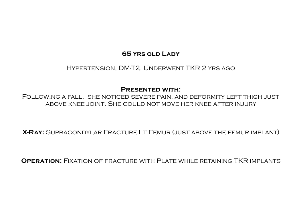 case18