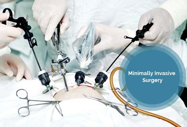 A minimally invasive surgical approach for the treatment of