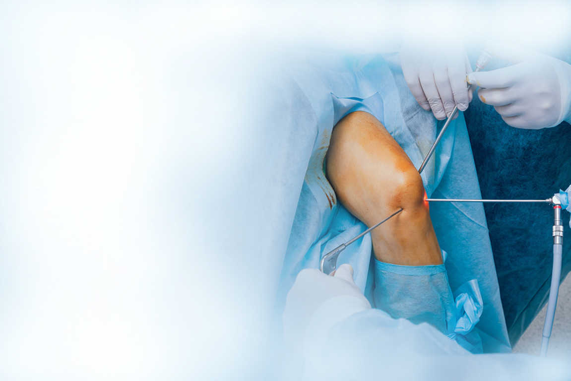 best kneee, hip and joint replacement surgeon in Delhi