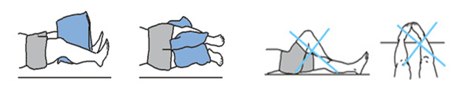 INSTRUCTIONS-AFTER-TOTAL-HIP-REPLACEMENT-right