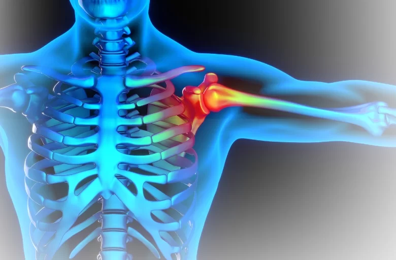 What is Osteoarthritis?