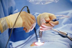 Best Minimally Invasive Surgeon In Delhi