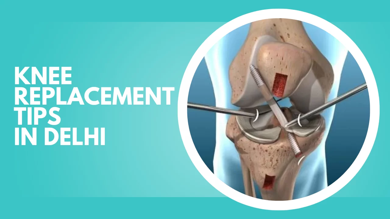 What is Osteoarthritis?