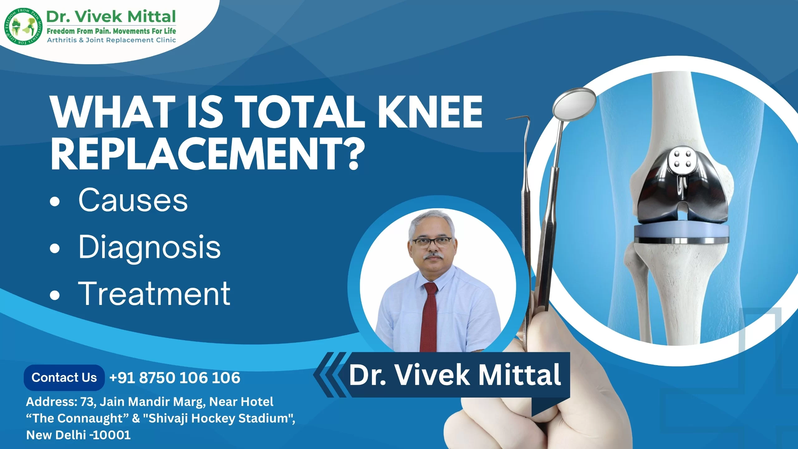 What is Osteoarthritis?