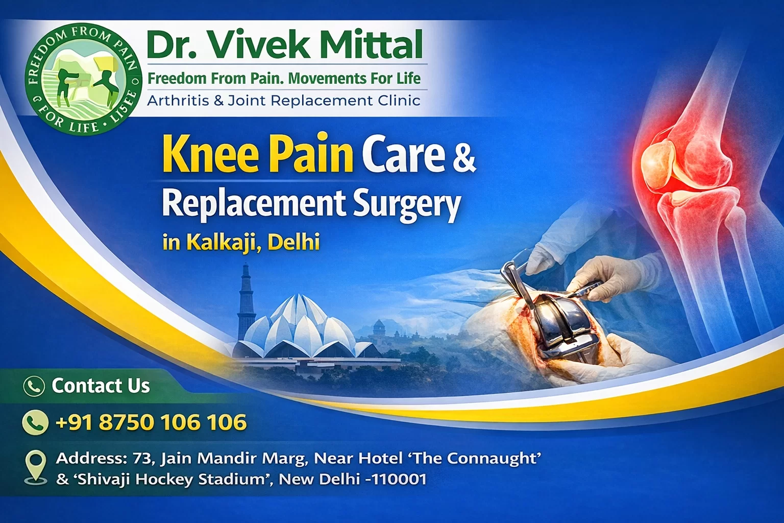 What is Osteoarthritis?
